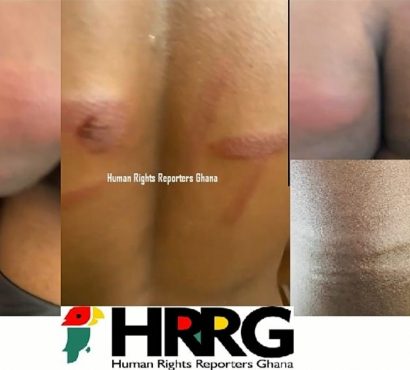 Heartbreaking Video:Gross Abuse as Annor Adjaye SHS Teachers cane students to pulp-HRRG